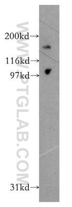 DCBLD2 Antibody in Western Blot (WB)