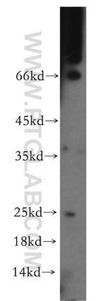 CIDEA Antibody in Western Blot (WB)