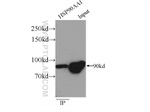 HSP90 Antibody in Immunoprecipitation (IP)