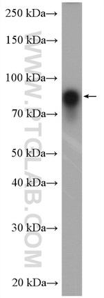 HSP90 Antibody in Western Blot (WB)