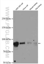 HSP90 Antibody in Western Blot (WB)