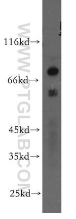 TBX5 Antibody in Western Blot (WB)