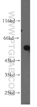 TBX5 Antibody in Western Blot (WB)