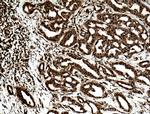 STAT5A Antibody in Immunohistochemistry (Paraffin) (IHC (P))