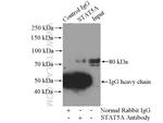 STAT5A Antibody in Immunoprecipitation (IP)