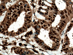 STAT5A Antibody in Immunohistochemistry (Paraffin) (IHC (P))