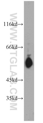 STAT5A Antibody in Western Blot (WB)