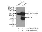 SNX20 Antibody in Immunoprecipitation (IP)