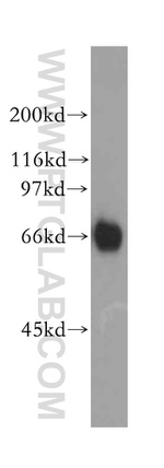 RBBP5 Antibody in Western Blot (WB)