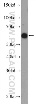 RBBP5 Antibody in Western Blot (WB)