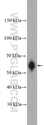 RBBP5 Antibody in Western Blot (WB)