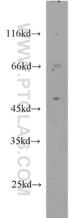 TFAP2B Antibody in Western Blot (WB)