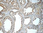 MLF1IP Antibody in Immunohistochemistry (Paraffin) (IHC (P))