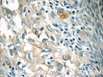 RAB25 Antibody in Immunohistochemistry (Paraffin) (IHC (P))