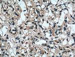 RAB25 Antibody in Immunohistochemistry (Paraffin) (IHC (P))