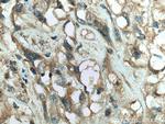 RAB25 Antibody in Immunohistochemistry (Paraffin) (IHC (P))