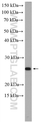 RAB25 Antibody in Western Blot (WB)