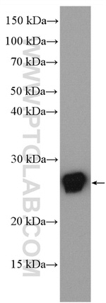 RAB25 Antibody in Western Blot (WB)