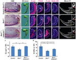 P-cadherin Antibody in Immunohistochemistry (Paraffin) (IHC (P))