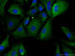 SAA2 Antibody in Immunocytochemistry (ICC/IF)