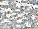 SAA2 Antibody in Immunohistochemistry (Paraffin) (IHC (P))