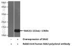 SAA2 Antibody in Western Blot (WB)