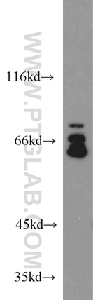 FXR1 Antibody in Western Blot (WB)