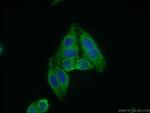 DCLRE1B Antibody in Immunocytochemistry (ICC/IF)