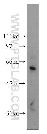 DCLRE1B Antibody in Western Blot (WB)