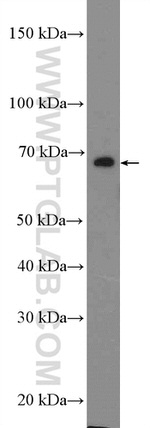 DCLRE1B Antibody in Western Blot (WB)