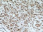 AK3L1 Antibody in Immunohistochemistry (Paraffin) (IHC (P))