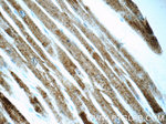 CKMT2 Antibody in Immunohistochemistry (Paraffin) (IHC (P))