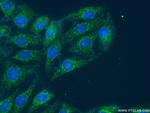 UBA6 Antibody in Immunocytochemistry (ICC/IF)