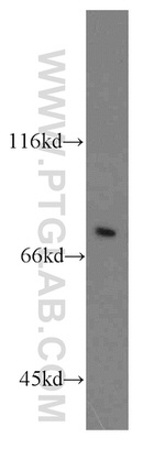 SOX5 Antibody in Western Blot (WB)