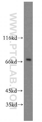 SOX5 Antibody in Western Blot (WB)