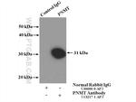 PNMT Antibody in Immunoprecipitation (IP)