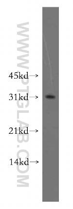 PNMT Antibody in Western Blot (WB)