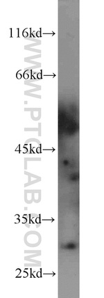 PNMT Antibody in Western Blot (WB)