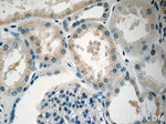 PIP4K2B Antibody in Immunohistochemistry (Paraffin) (IHC (P))