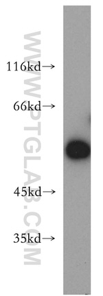 PIP4K2B Antibody in Western Blot (WB)