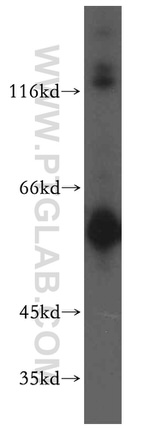 PIP4K2B Antibody in Western Blot (WB)