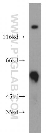 PIP4K2B Antibody in Western Blot (WB)