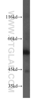 PIP4K2B Antibody in Western Blot (WB)