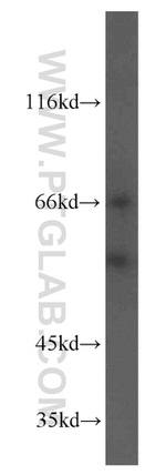 PIP4K2B Antibody in Western Blot (WB)