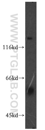 PIP4K2B Antibody in Western Blot (WB)