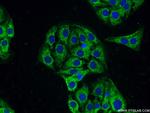 PACSIN1 Antibody in Immunocytochemistry (ICC/IF)
