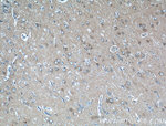 PACSIN1 Antibody in Immunohistochemistry (Paraffin) (IHC (P))