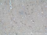 PACSIN1 Antibody in Immunohistochemistry (Paraffin) (IHC (P))