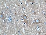 PACSIN1 Antibody in Immunohistochemistry (Paraffin) (IHC (P))