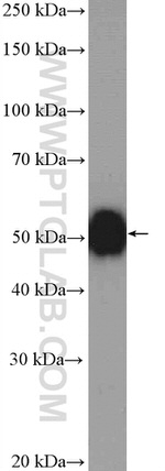 PACSIN1 Antibody in Western Blot (WB)